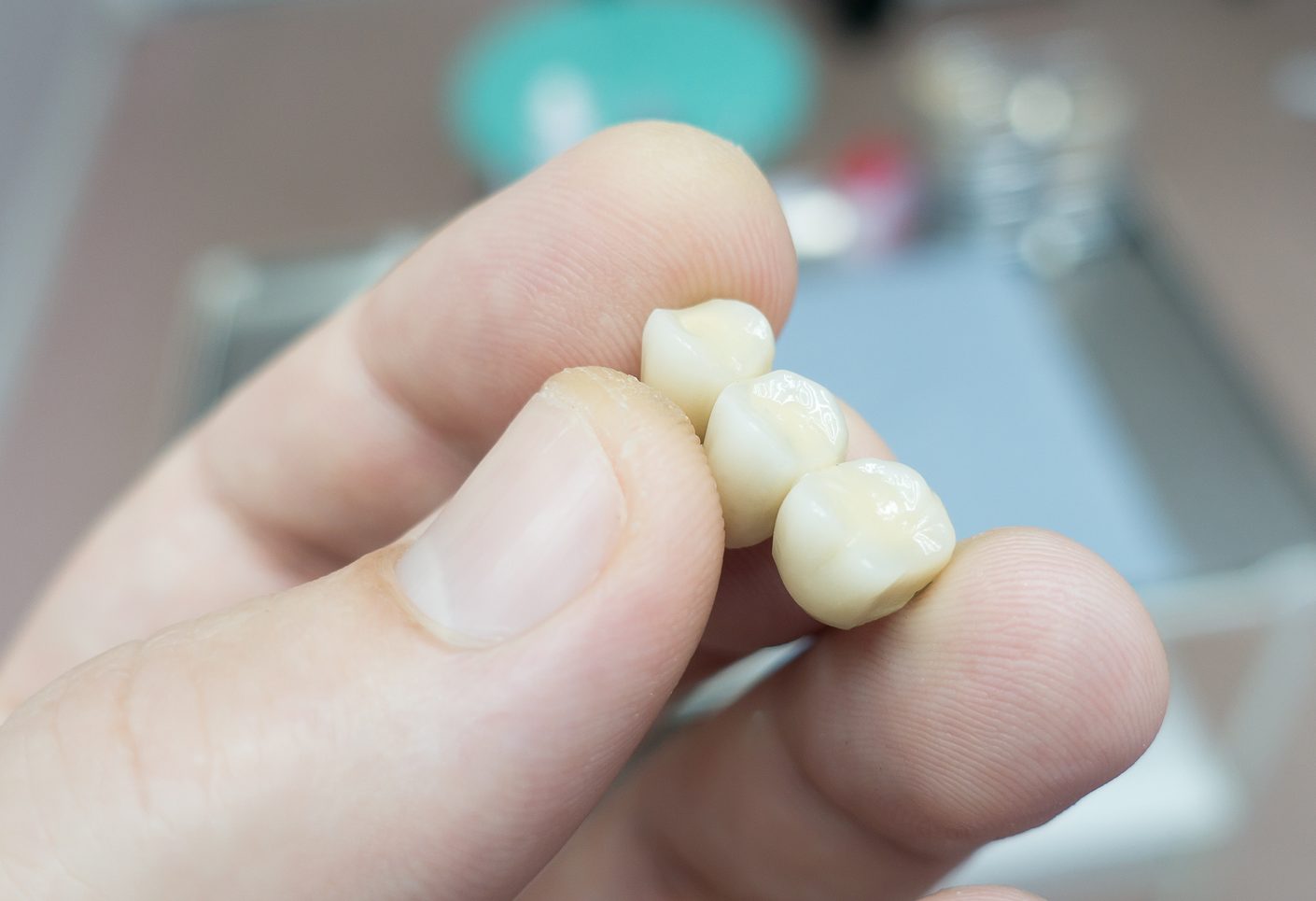 Dental bridge in the hands